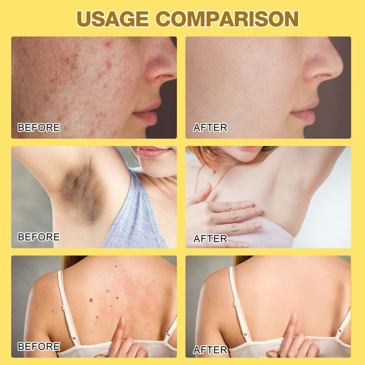 Bee Venom Skin Treatment Cream